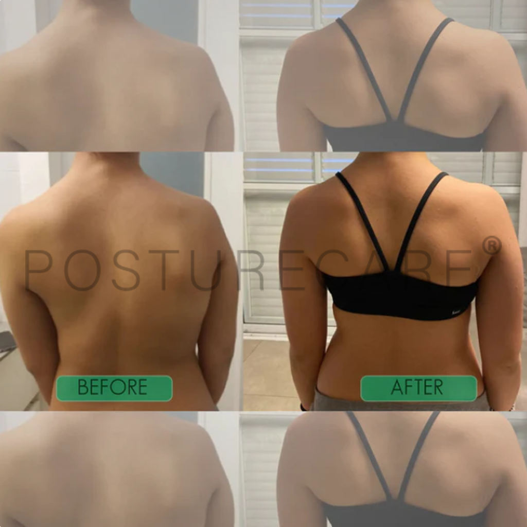 Instant Posture Corrector