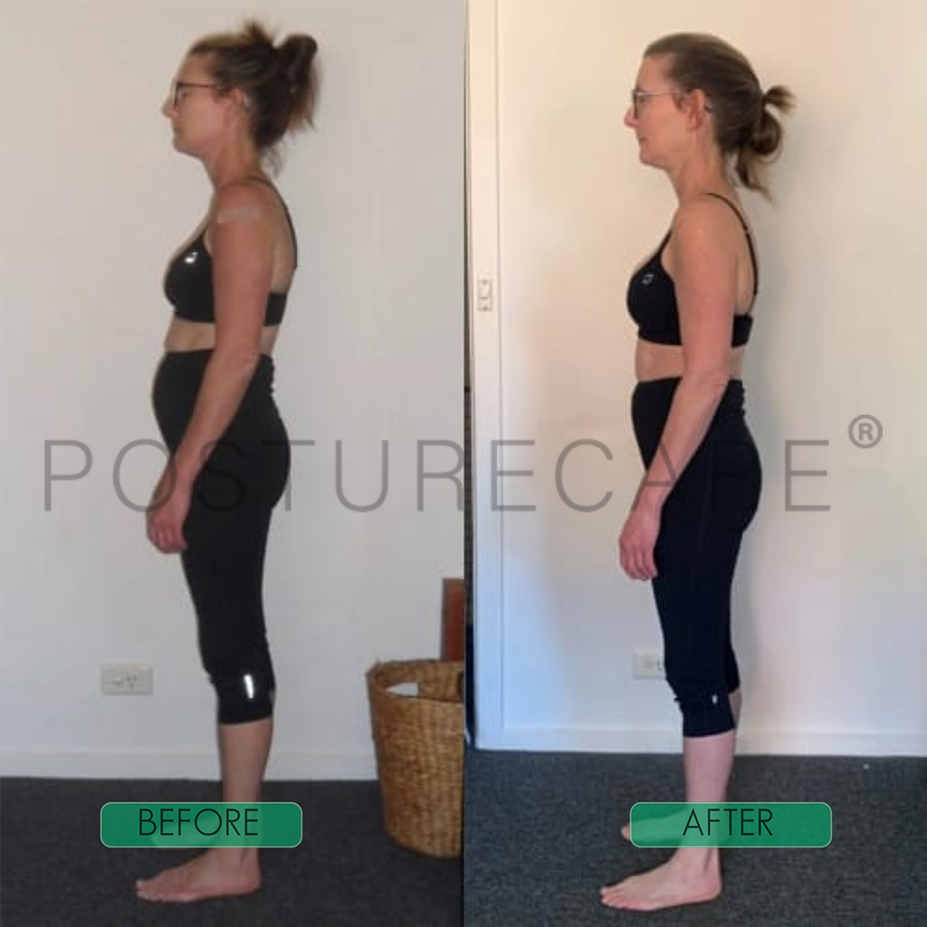 Instant Posture Corrector